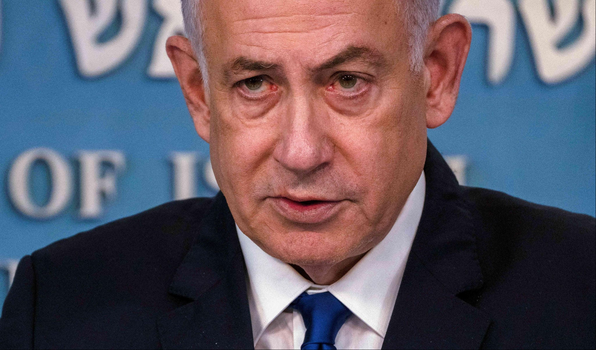 Primeiro-ministro israelense, Benjamin Netanyahu, foi operado com sucesso