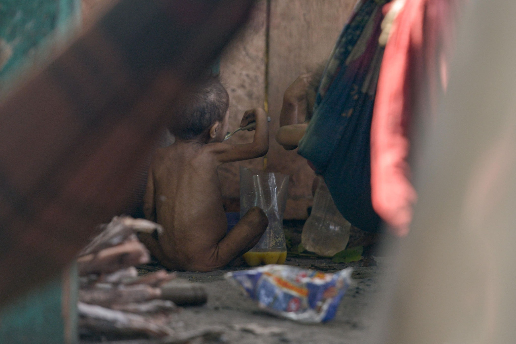 Criança Yanomami come após receber atendimento em centro de saúde próximo a aldeias na serra dos Surucucus. Foto: Fred Magno/ O TEMPO